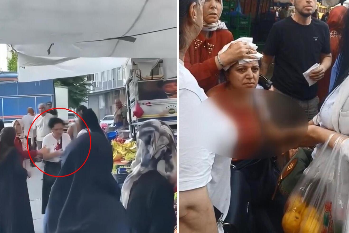 Görüntüler semt pazarından: “Armut” kavgasında kadının kafasını kalasla kırdı