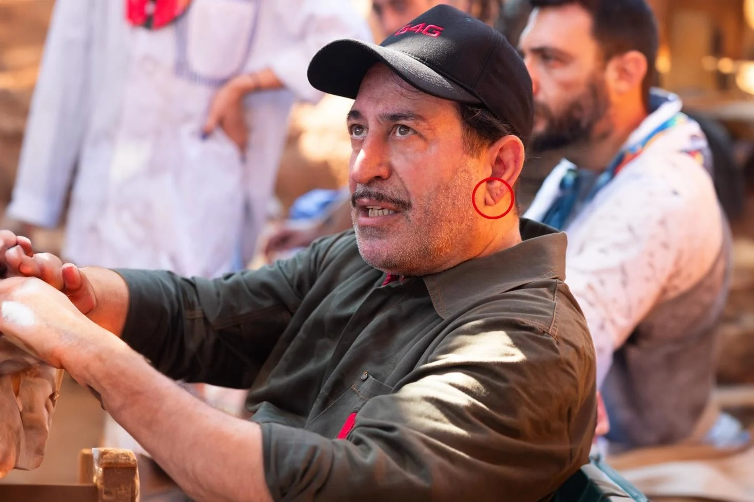 Cem Yılmaz’ın kalp krizi sonrası herkes bu detaya takıldı