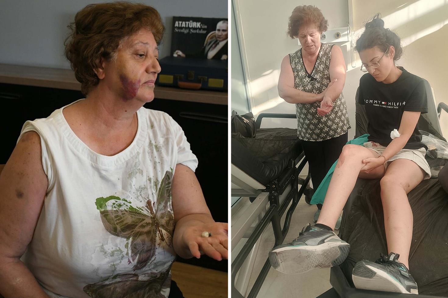 Kuşadası’nda ev işgali dehşeti: Anne, kızı ve oğlu bıçaklandı