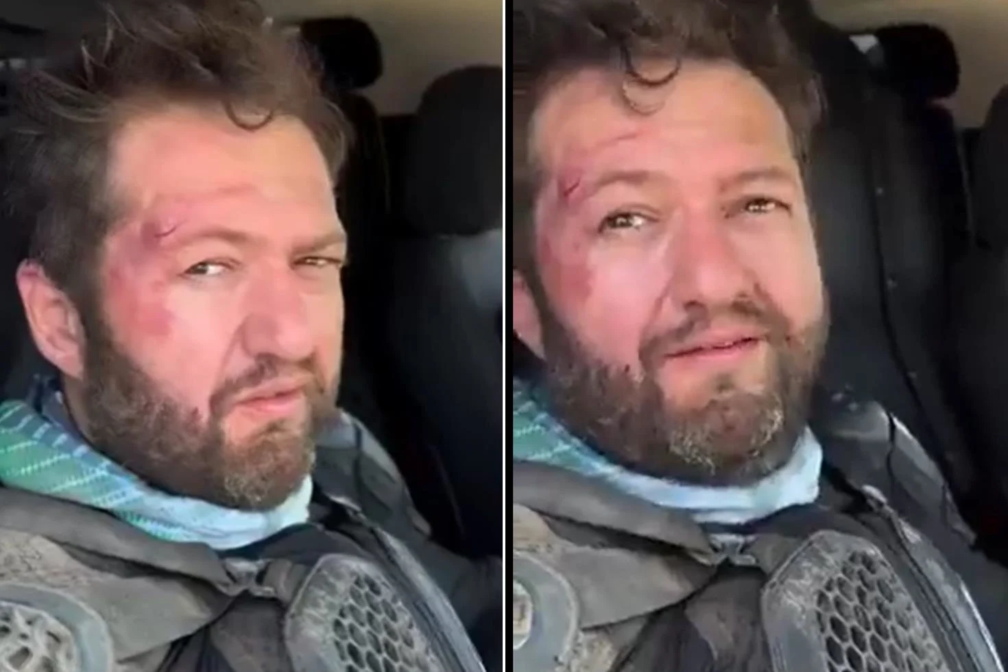 Fenomen Ömer Başdoğan motosiklet kazası geçirdi