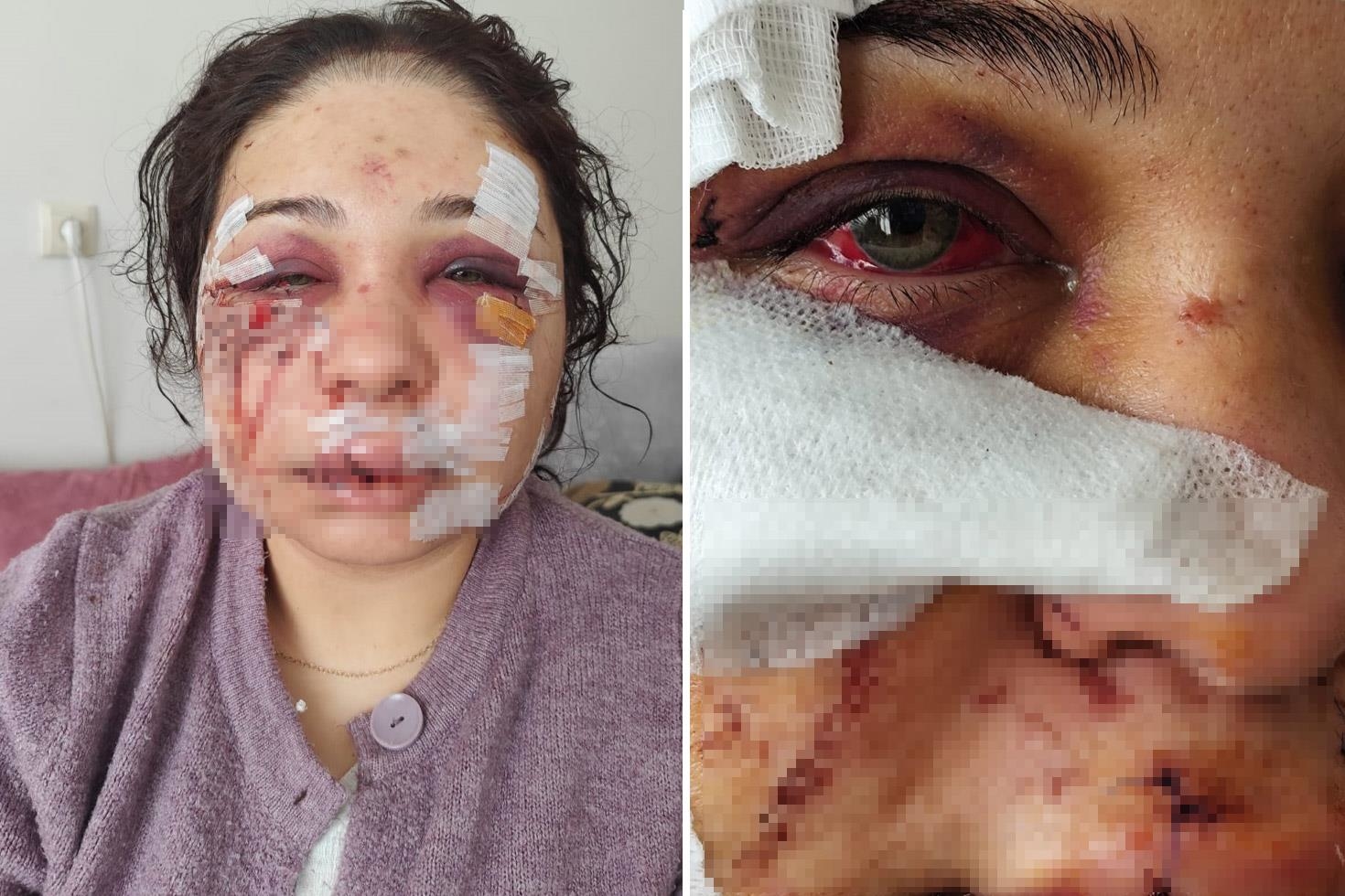 Polis memuru kocasının öldüresiye dövdüğü kadına hapis şoku