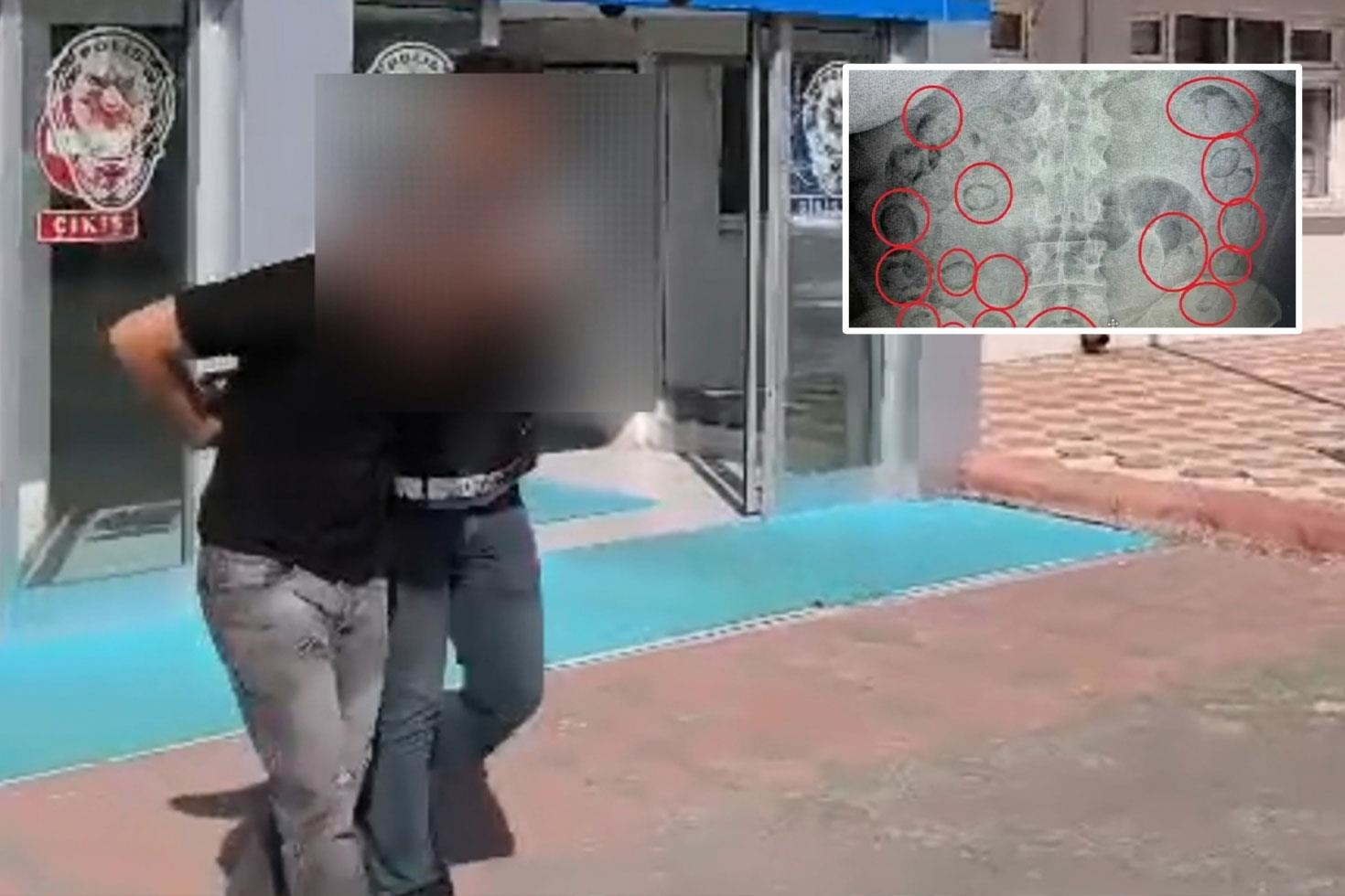 Midesinde 500 gram uyuşturucuyla yakalandı