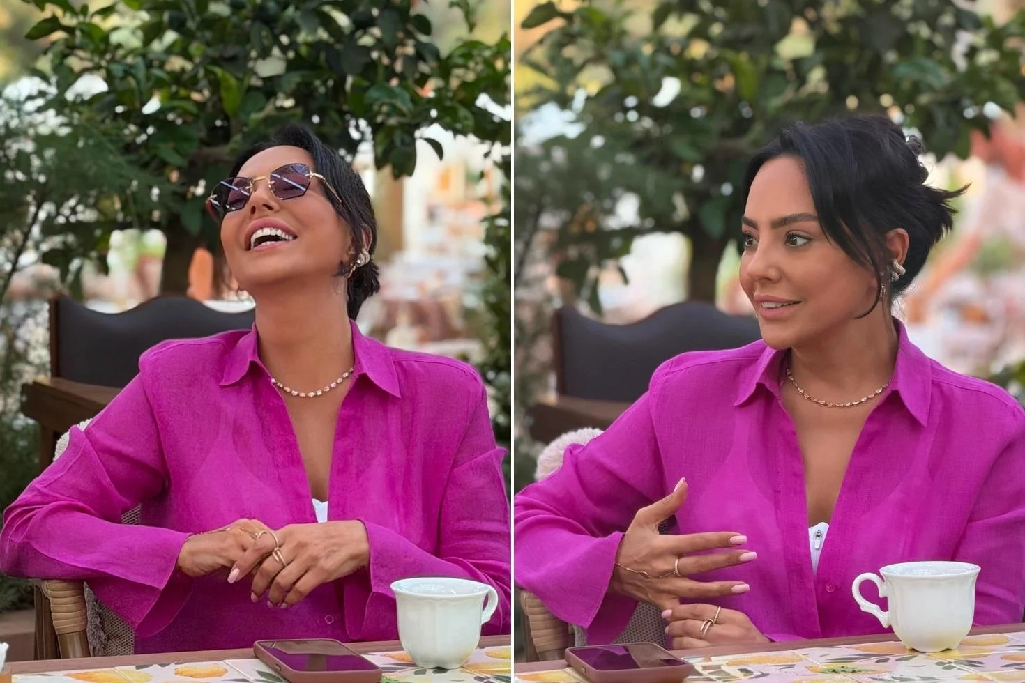 Estetik operasyon için 10 milyon TL veren Ebru Gündeş’in son hali ortaya çıktı