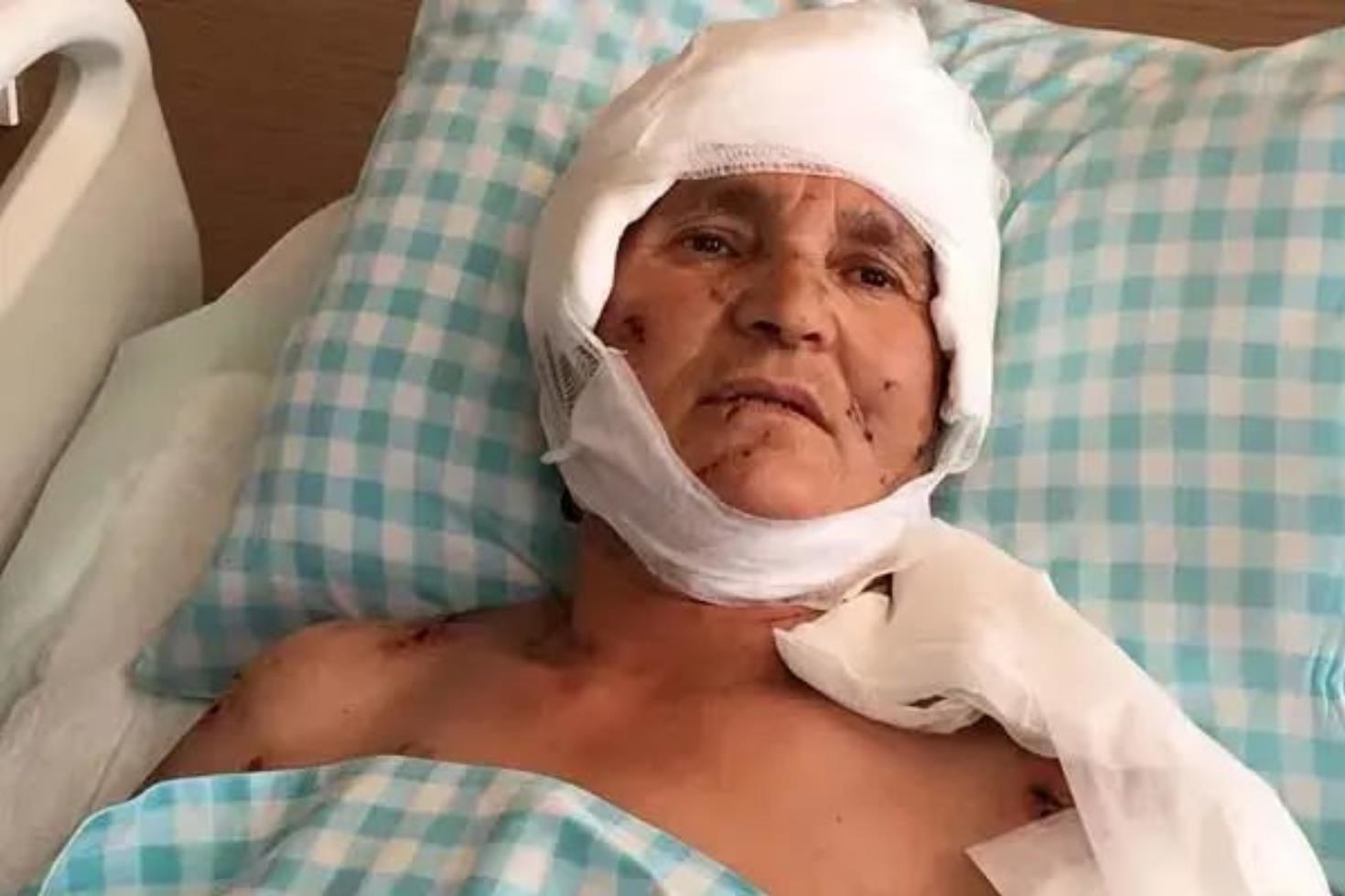 Yaşlı kadın evinin önünde dehşeti yaşadı: Yargıtay’dan köpek saldırısında emsal karar