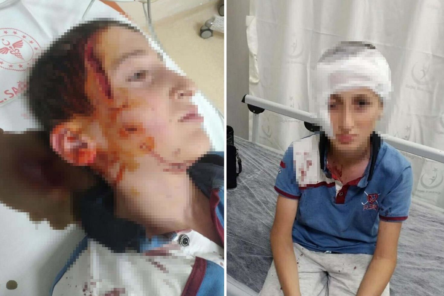 O Kopegin Sahibi Icin Karar Iste Odeyecegi Tazminat Miktari 20198793 70 Jpg